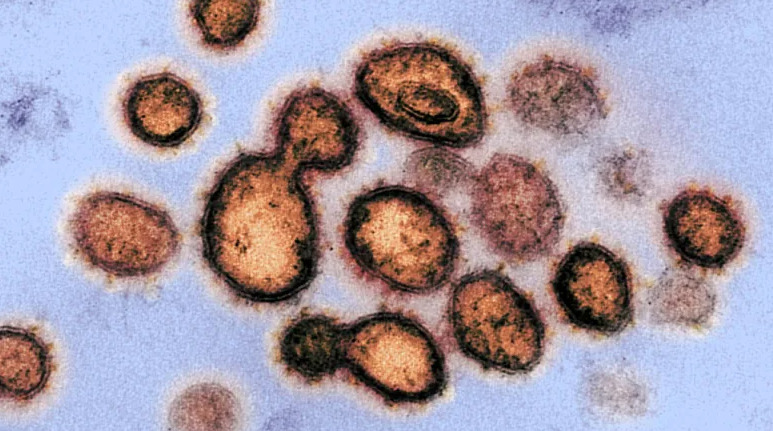 Hình ảnh kính hiển vi điện tử truyền qua này cho thấy SARS-CoV-2, vi rút gây ra COVID-19, được phân lập từ một bệnh nhân ở Hoa Kỳ Các hạt vi rút xuất hiện từ bề mặt của tế bào được nuôi cấy trong phòng thí nghiệm. (NIAID)