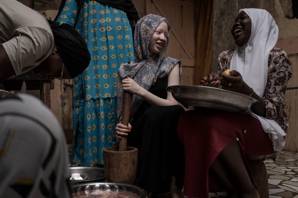 Penda Fall giúp gia đình làm việc nhà trong Ngày Quốc tế Nhận thức về Người bạch tạng ở Dakar (Sénégal). (Ảnh: Annika Hammerschlag/Anadolu Agency/Getty Images)