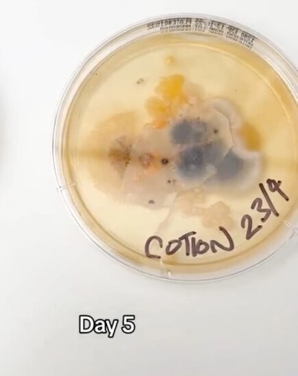 Chỉ sau vài ngày, chiếc vỏ gối chưa giặt đã sinh sôi nảy nở vi khuẩn trong đĩa petri. Ảnh: @simonandbee/TikTok