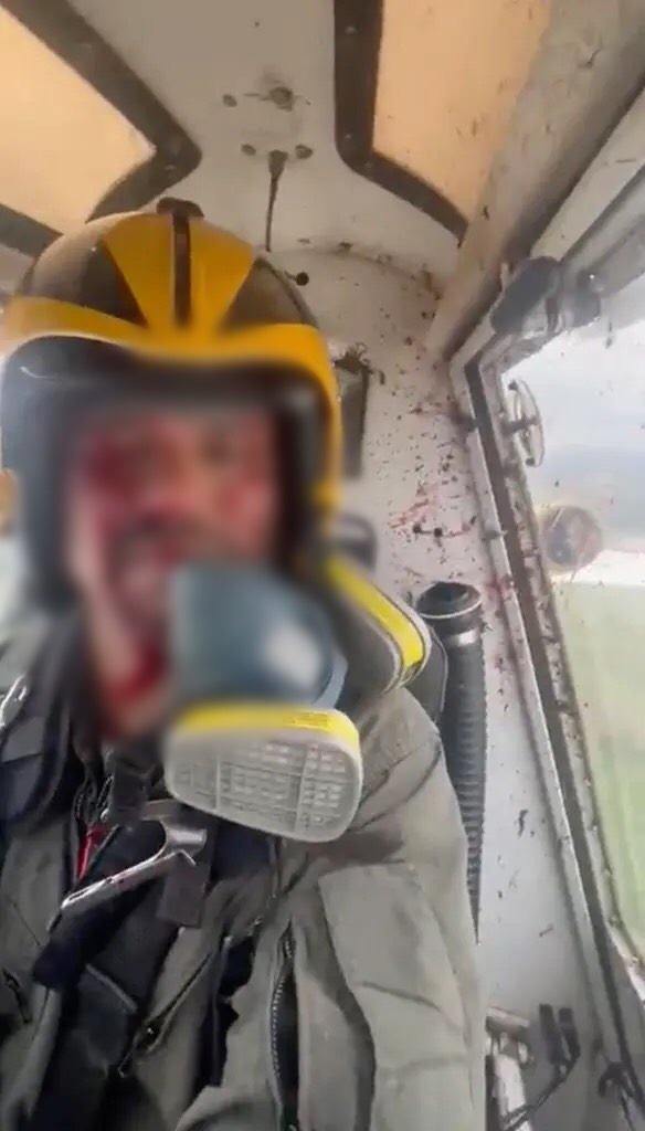 Phi công Ariel Valiente bị thương sau khi con chim đâm vào kính chắn gió máy bay.