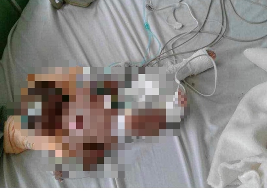 Bé trai 3 tháng tuổi có nhiều vết thương trên cơ thể. (Ảnh chụp màn hình - nguồn L.A.)