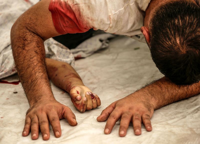 Một người đàn ông Palestine đau buồn sau khi cháu trai mình thiệt mạng trong cuộc không kích của Israel ở Gaza. (Ảnh: Mohammed Sabre/EFP - EFE/Shutterstock)