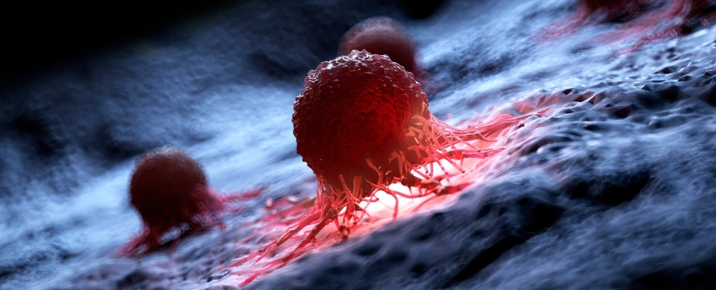 Hình minh họa của một tế bào ung thư. (Ảnh: CP)  