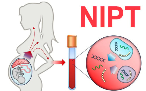 Sàng lọc trước sinh bằng xét nghiệm NIPT cho kết quả chính xác cao