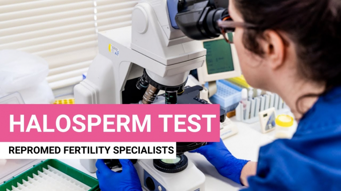 Xét nghiệm Halosperm để xét nghiệm kiểm tra nhanh chất lượng tinh trùng ở mức độ di truyền và mức độ đứt gãy ADN của tinh trùng