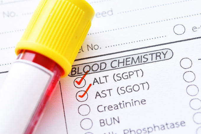 SGPT trong xét nghiệm máu là gì? Đây chính là chỉ số cảnh báo rõ nét hơn những tổn thương ở gan