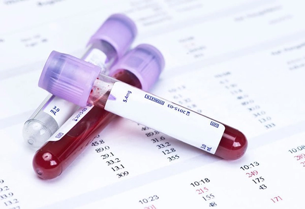 Trong xét nghiệm công thức máu gồm nhiều loại chỉ số khác nhau