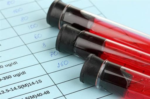 Chỉ số PCT trong máu thấp có liên quan đến bệnh lý gì?
