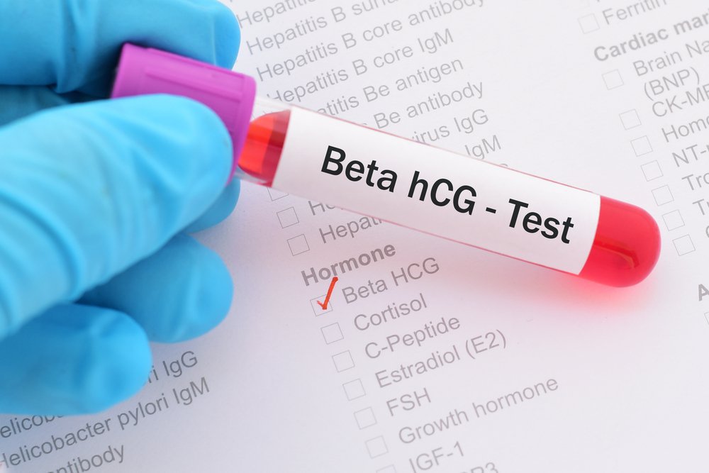 Nếu kết quả xét nghiệm beta hCG cho thấy đã có thai thì nên làm gì tiếp theo?
