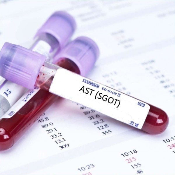 AST giúp xác định tình trạng gì trong gan?
