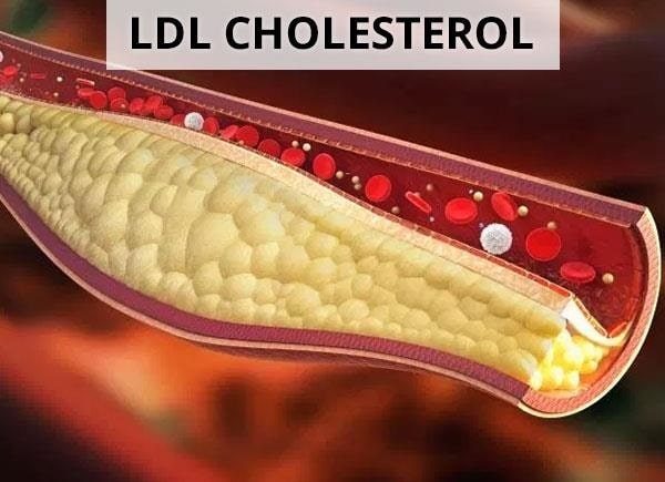 Giá xét nghiệm máu LDL-C là bao nhiêu?