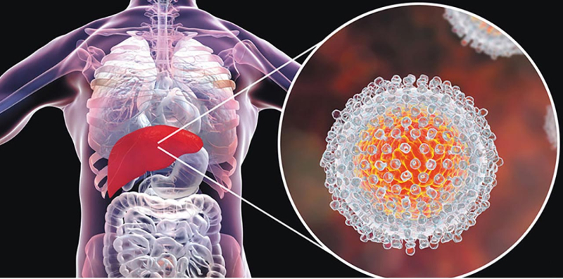 Các phương pháp điều trị viêm gan C liên quan đến HCV Ag như thế nào?