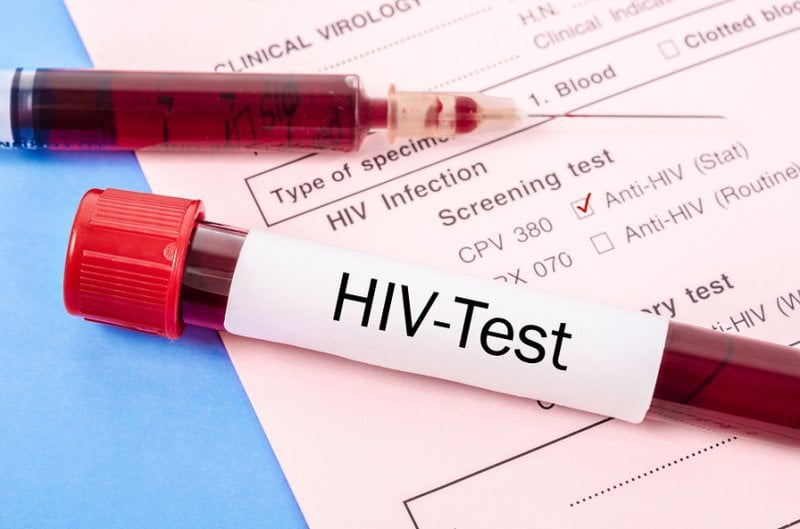 HIV Combi PT cần mẫu máu như thế nào?
