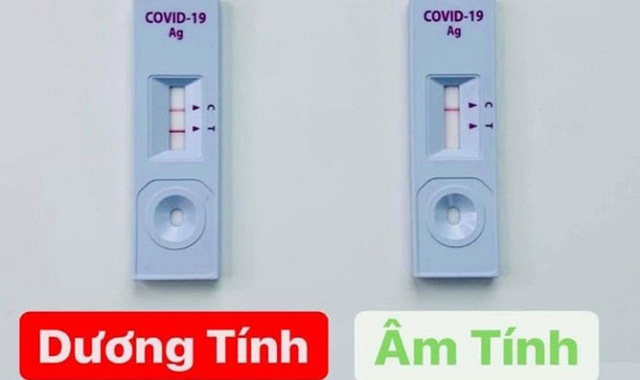 Vạch mờ hay đậm không nói lên được bệnh nặng, nhẹ, nhiều hay ít virus SARS-CoV-2. Ngoài ra, khi có xét nghiệm test nhanh dương tính cũng không nhất thiết phải làm xét nghiệm RT-PCR khẳng định.