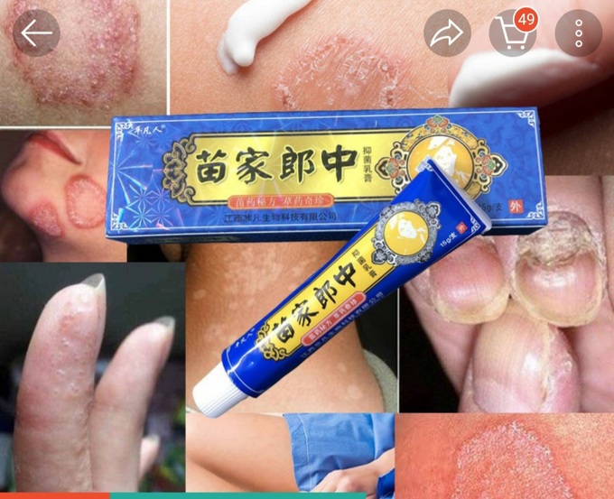 Người tiêu dùng cẩn trọng không dùng các loại thuốc bôi da trên mạng.