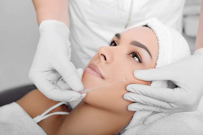 Căng chỉ da mặt cũng tiềm ẩn những rủi ro nhất định.