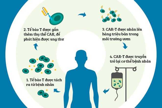 Quy trình thực hiện liệu pháp tế bào CAR-T. Ảnh: Bệnh viện 108