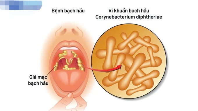 bạch hầukk