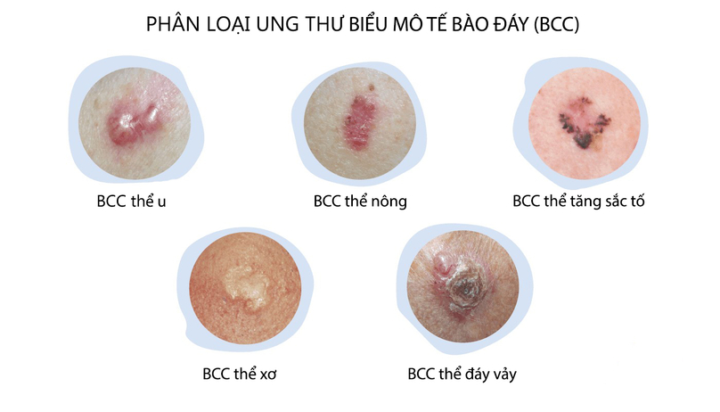 Các Biểu Hiện Bất Thường Trên Da