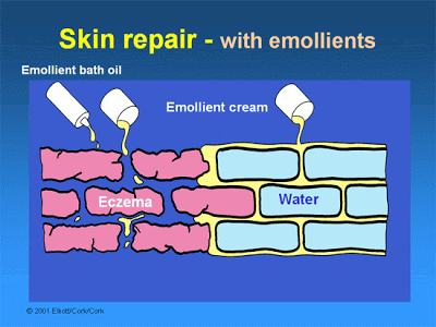 Kem Mustela Stelatopia Emollient có hiệu quả trong việc dưỡng ẩm cho người bị viêm da cơ địa không?
