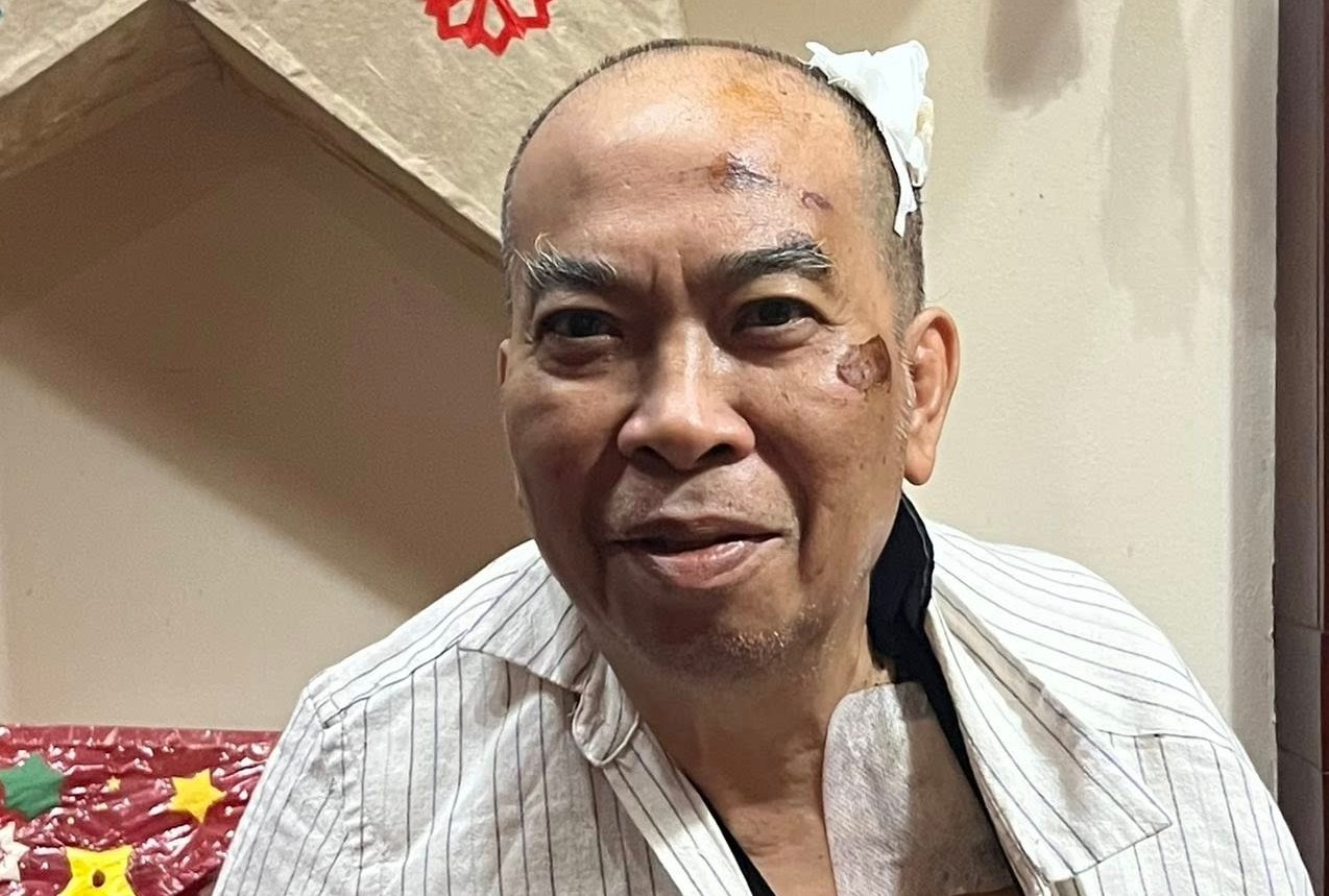 Thông tin mới nhất về sức khỏe của Chủ tịch Hội Nhà văn Việt Nam sau vụ tai nạn gãy xương