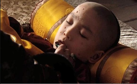 khang hy, vua khang hy, bệnh đậu mùa, khang hy chữa bệnh đậu mùa, Khang Hy dùng 30 cung nữ chữa bệnh đậu mùa