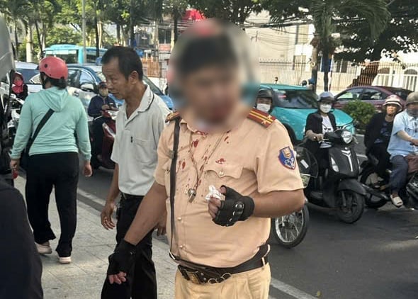 TIN NÓNG 24 GIỜ QUA: Điều tra nghi án chồng sát hại vợ rồi tự tử; một du khách nước ngoài tấn công CSGT