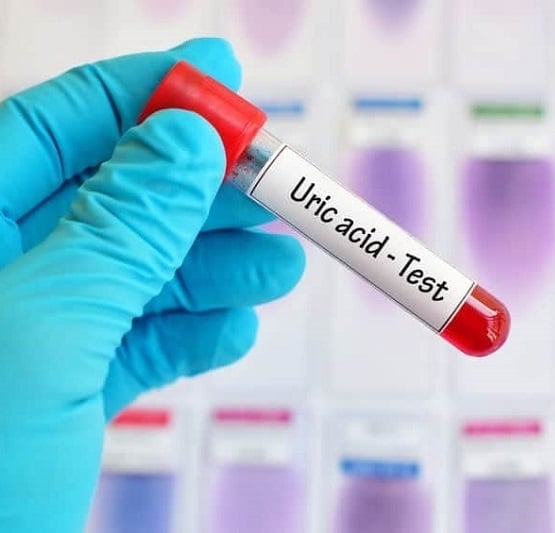 Lưu ngay các cách hạ axit uric an toàn, hiệu quả