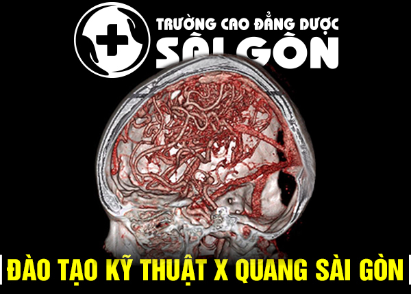 Dao-tao-ky-thuat-xquang-sai-gon-pasteur-26-12