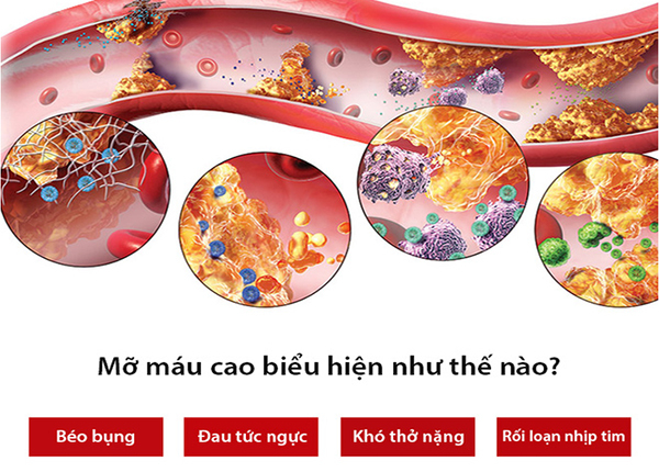 Những biểu hiện của bệnh nhân bị mỡ máu cao