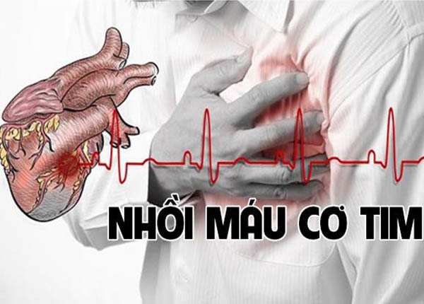 Nhồi máu cơ tim là một căn bệnh nguy hiểm