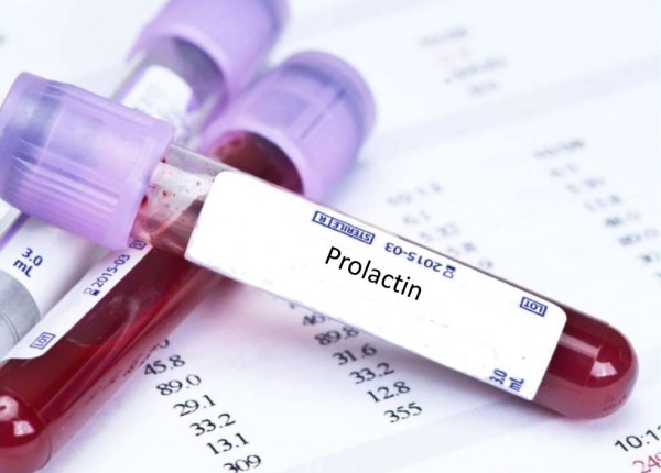 Prolactin là một hormone quan trọng trong cơ thể