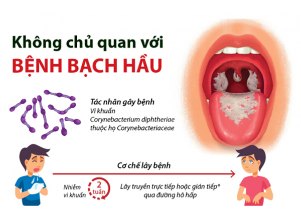 Bệnh bạch hầu là một bệnh vừa nhiễm độc vừa nhiễm trùng