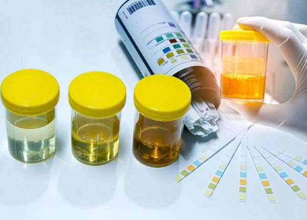 Xét nghiệm cấy nước tiểu cho biết chính xác lại vi khuẩn gây bệnh và kháng sinh nào có tác dụng điều trị