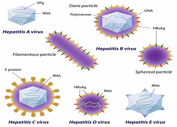 Viêm gan siêu vi cấp tính có thể do năm loại virus viêm gan gây ra