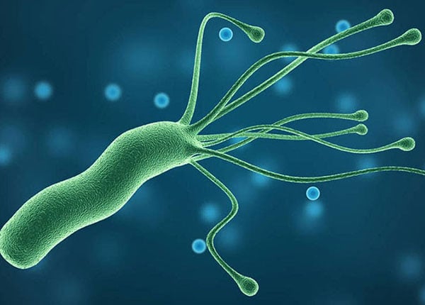 Nhiễm vi khuẩn HP dạ dày là tình trạng phổ biến trên thế giới