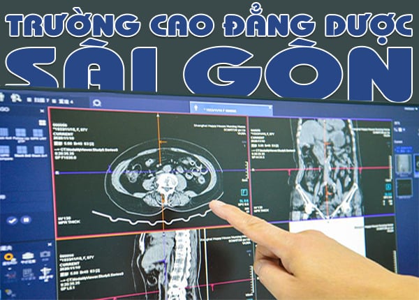 Hoc-phi-Cao-dang-nganh-Ky-thuat-hinh-anh-Y-hoc-Sai-Gon-01