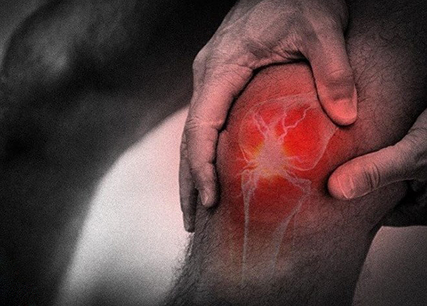 Bệnh viêm khớp gối tràn dịch Bệnh viêm khớp gối tràn dịch