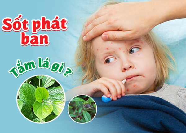 Lá tắm tốt cho trẻ sốt phát ban Lá tắm tốt cho trẻ sốt phát ban