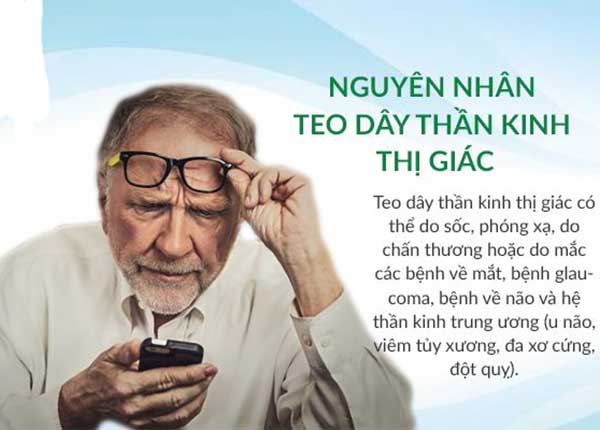 Nguyên nhân gây bệnh teo dây thần kinh thị giác