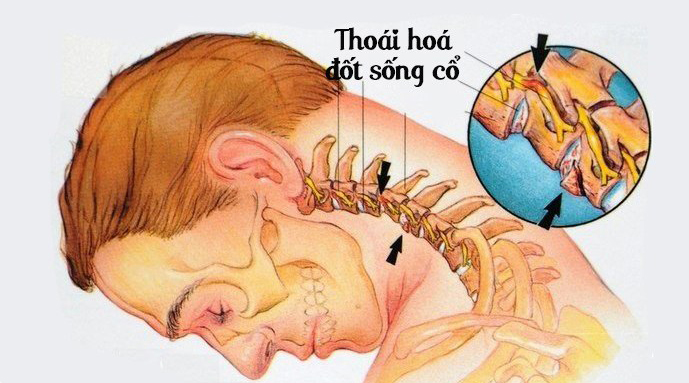 thoai-hoa-dot-song-co