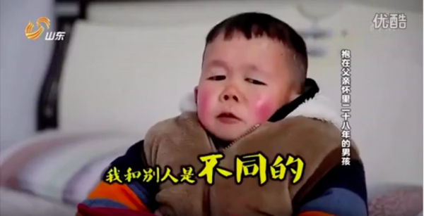 Chàng trai 30 tuổi mang hình hài của một đứa trẻ lên 2 vì căn bệnh lạ 1