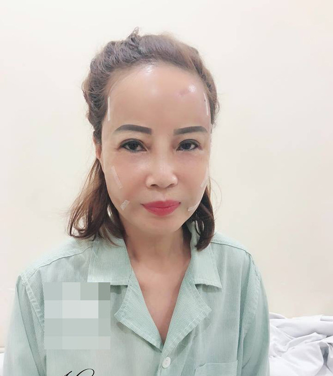 Cô dâu 62 tuổi ở Cao Bằng phẫu thuật thẩm mỹ, diện mạo mới trẻ trung như tuổi 40 3