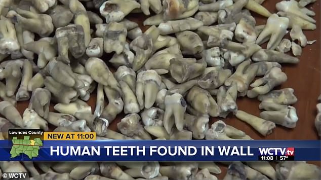 Công nhân phát hoảng khi phát hiện 1.000 chiếc răng người được chôn trong tường 1