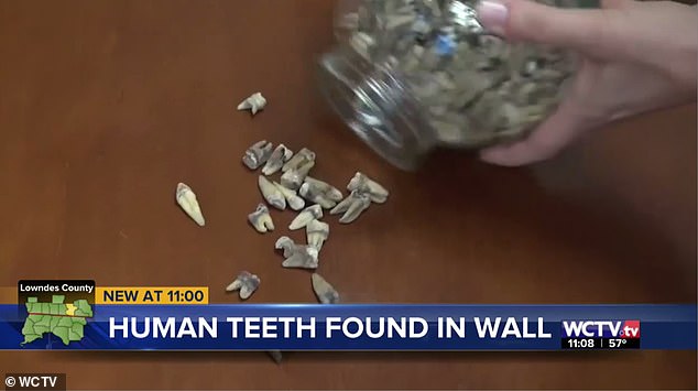 Công nhân phát hoảng khi phát hiện 1.000 chiếc răng người được chôn trong tường 2
