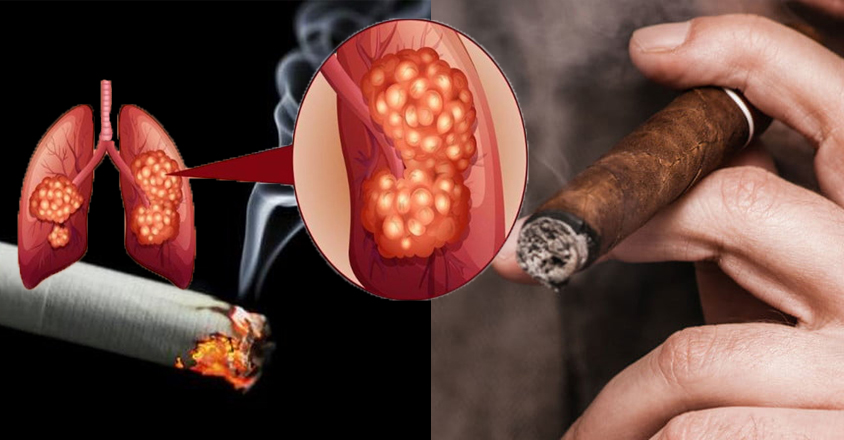 Xì gà và thuốc lá loại nào có hại hơn? 2