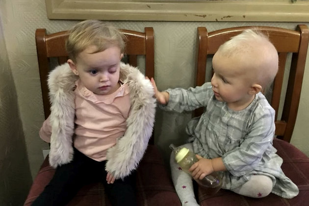 Bé Lydia (bên trái) và bé Felicity (bên phải) gần bằng tuổi nhau và cùng mắc bệnh ung thư mắt hiếm gặp