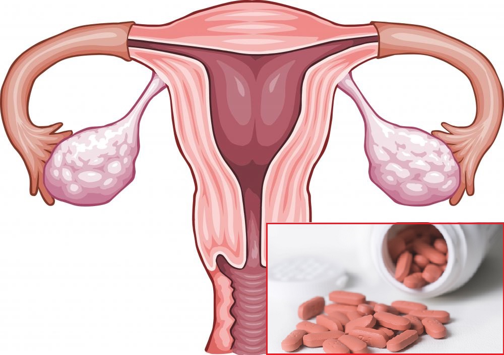 Thuốc Ibuprofen có thể ảnh hưởng đến tương lai sức khỏe sinh sản của thai nhi hàng chục năm sau