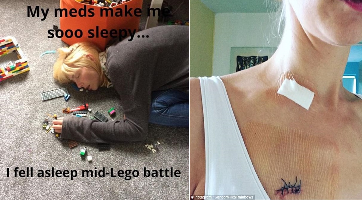 Bức ảnh chụp Laura Corrigan kiệt sức bên đống Lego của con và những vết thương do điều trị bệnh của chị
