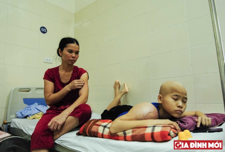 Một bệnh nhân ung thư trẻ em tại Bệnh viện K Tân Triều (Hà Nội)
